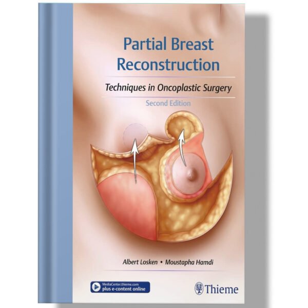 Partial Breast Reconstruction: Techniques in Oncoplastic Surgery 2nd Edition